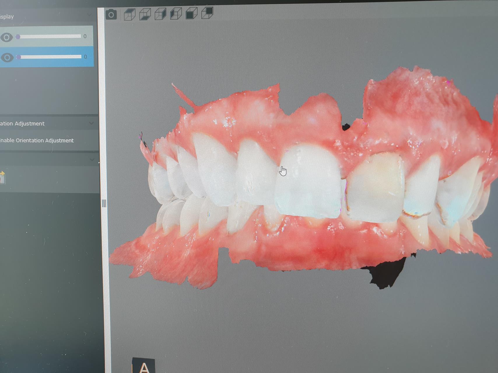 gabinet-dentystyczny-ruczaj-26 Stomatologia zachowawcza